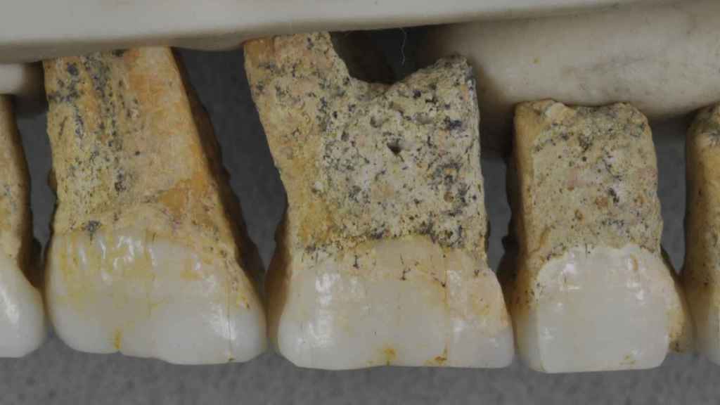 Dentadura superior derecha de Homo luzonensis