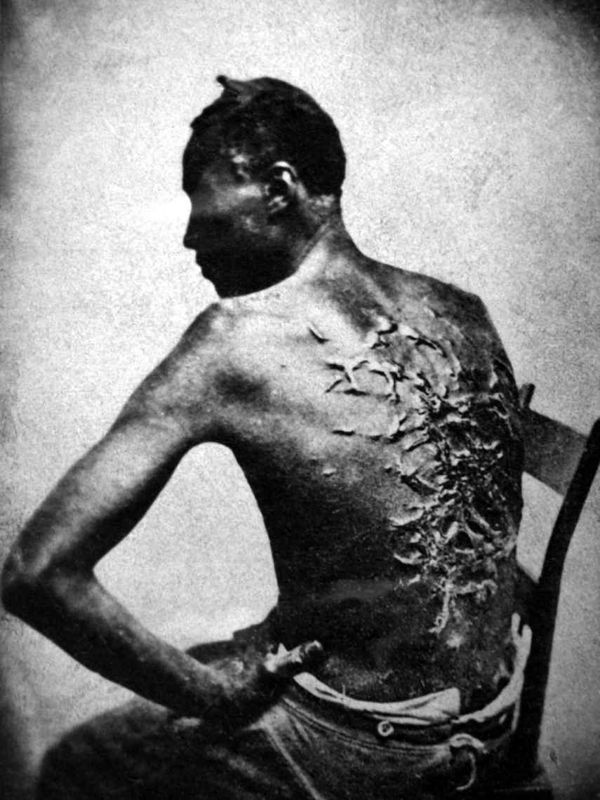 Peter, un esclavo de Mississippi. Las cicatrices son resultado de los azotes de su capataz. Estuvo dos meses recuperándose de la paliza (1863).